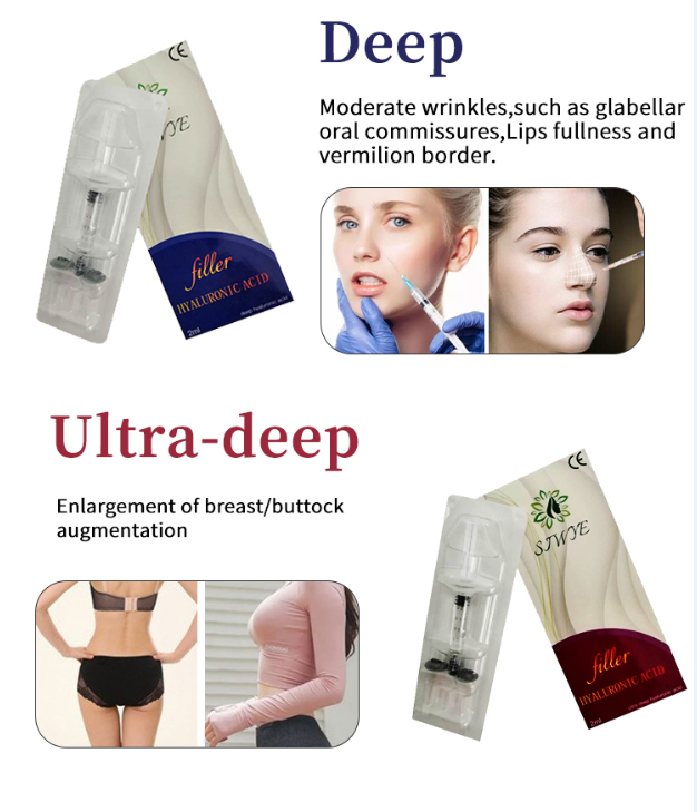 Deep 2ml 1ml Hyaluronic Acid Lip Fillers Female Injectable OEM